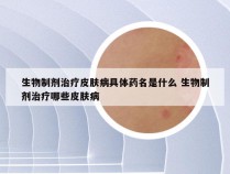 生物制剂治疗皮肤病具体药名是什么 生物制剂治疗哪些皮肤病