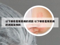以下哪些是银屑病的诱因 以下哪些是银屑病的诱因及预防