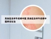 高血压合并牛皮癣中医 高血压合并牛皮癣中医辨证论治