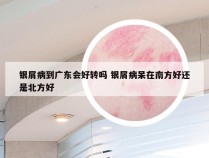银屑病到广东会好转吗 银屑病呆在南方好还是北方好
