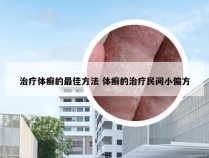 治疗体癣的最佳方法 体癣的治疗民间小偏方