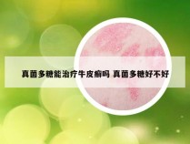 真菌多糖能治疗牛皮癣吗 真菌多糖好不好
