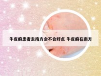 牛皮癣患者去南方会不会好点 牛皮癣在南方