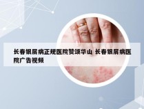 长春银屑病正规医院赞颂华山 长春银屑病医院广告视频