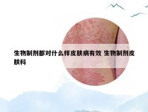 生物制剂都对什么样皮肤病有效 生物制剂皮肤科