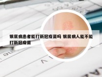 银屑病患者能打新冠疫苗吗 银屑病人能不能打新冠疫苗