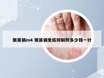 银屑病m4 银屑病免疫抑制剂多少钱一针