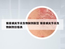 银屑病关节炎生物制剂新型 银屑病关节炎生物制剂价格表