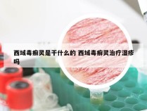 西域毒癣灵是干什么的 西域毒癣灵治疗湿疹吗