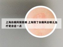 上海白癜风银屑病 上海得了白癜风去哪儿治疗更合适一点