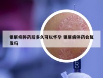 银屑病停药后多久可以怀孕 银屑病停药会复发吗