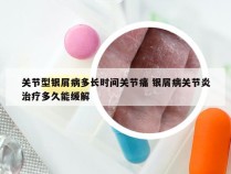 关节型银屑病多长时间关节痛 银屑病关节炎治疗多久能缓解