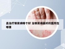 昌治疗银屑病哪个好 治银屑病最好的医院在哪里