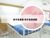 蚊子包变癣 蚊子包变成癣