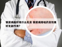 银屑病最好用什么乳膏 银屑病用啥药膏效果好无副作用?