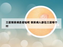 三亚银屑病患者贴吧 银屑病人都在三亚哪个村