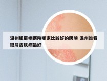 温州银屑病医院哪家比较好的医院 温州谁看银屑皮肤病最好