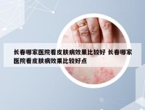 长春哪家医院看皮肤病效果比较好 长春哪家医院看皮肤病效果比较好点