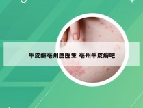 牛皮癣亳州唐医生 亳州牛皮癣吧