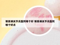 银屑病关节炎医院哪个好 银屑病关节炎医院哪个好点