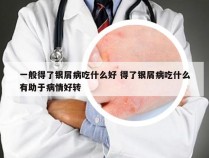 一般得了银屑病吃什么好 得了银屑病吃什么有助于病情好转