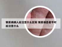 银屑病病人应注意什么区别 银屑病患者平时应注意什么