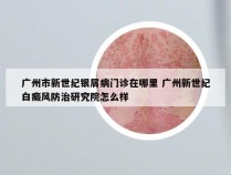 广州市新世纪银屑病门诊在哪里 广州新世纪白癜风防治研究院怎么样