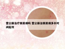 雷公藤治疗银屑病吗 雷公藤治银屑病多长时间起效
