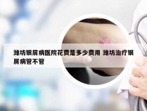 潍坊银屑病医院花费是多少费用 潍坊治疗银屑病管不管