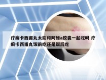 疗癣卡西甫丸太能和阿维a胶囊一起吃吗 疗癣卡西甫丸饭前吃还是饭后吃