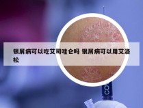 银屑病可以吃艾司唑仑吗 银屑病可以用艾洛松