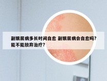 副银屑病多长时间自愈 副银屑病会自愈吗?能不能放弃治疗?