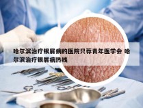 哈尔滨治疗银屑病的医院只荐青年医学会 哈尔滨治疗银屑病热线