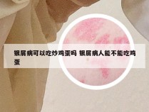 银屑病可以吃炒鸡蛋吗 银屑病人能不能吃鸡蛋