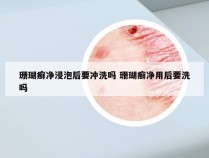 珊瑚癣净浸泡后要冲洗吗 珊瑚癣净用后要洗吗