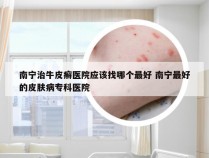 南宁治牛皮癣医院应该找哪个最好 南宁最好的皮肤病专科医院