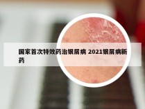 国家首次特效药治银屑病 2021银屑病新药