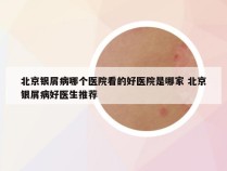 北京银屑病哪个医院看的好医院是哪家 北京银屑病好医生推荐