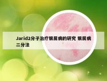 Jarid2分子治疗银屑病的研究 银屑病二分法