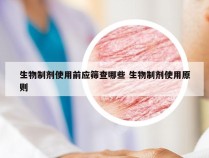 生物制剂使用前应筛查哪些 生物制剂使用原则