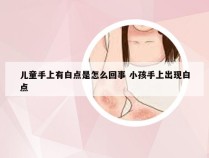 儿童手上有白点是怎么回事 小孩手上出现白点