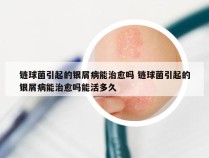 链球菌引起的银屑病能治愈吗 链球菌引起的银屑病能治愈吗能活多久