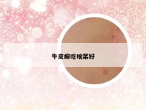 牛皮癣吃啥菜好