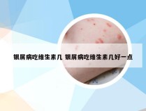 银屑病吃维生素几 银屑病吃维生素几好一点