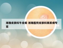 湘雅皮肤科牛皮癣 湘雅医院皮肤科银屑病专家