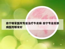 南宁哪家医院专业治疗牛皮癣 南宁专业皮肤病医院哪家好
