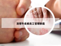 清理牛皮癣员工管理制度