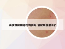 滴状银屑病能吃鸡肉吗 滴状银屑病忌口