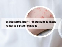 银屑病医院温州哪个比较好的医院 银屑病医院温州哪个比较好的医院有