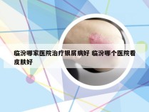 临汾哪家医院治疗银屑病好 临汾哪个医院看皮肤好